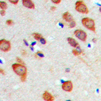 RPL22 / Ribosomal Protein L22 Antibody - Immunohistochemical analysis of RPL22 staining in human brain formalin fixed paraffin embedded tissue section. The section was pre-treated using heat mediated antigen retrieval with sodium citrate buffer (pH 6.0). The section was then incubated with the antibody at room temperature and detected using an HRP-conjugated compact polymer system. DAB was used as the chromogen. The section was then counterstained with hematoxylin and mounted with DPX.