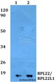 RPL22 / Ribosomal Protein L22 Antibody - Western blot of RPL22/ RPL22L1 antibody at 1:500 dilution. Lane 1: MCF-7 whole cell lysate. Lane 2: PC12 whole cell lysate.