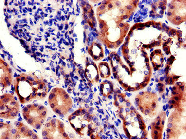 RPL22L1 Antibody - Immunohistochemistry of paraffin-embedded human kidney tissue using RPL22L1 Antibody at dilution of 1:100