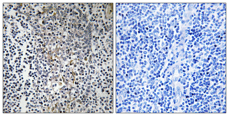 RPL23 / Ribosomal Protein L23 Antibody - Immunohistochemistry analysis of paraffin-embedded human tonsil tissue, using RPL23 Antibody. The picture on the right is blocked with the synthesized peptide.