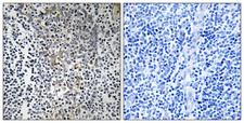 RPL23 / Ribosomal Protein L23 Antibody - Immunohistochemistry analysis of paraffin-embedded human tonsil tissue, using RPL23 Antibody. The picture on the right is blocked with the synthesized peptide.