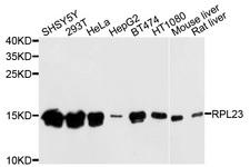 RPL23 / Ribosomal Protein L23 Antibody - Western blot analysis of extracts of various cells.