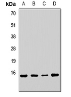 RPL23 / Ribosomal Protein L23 Antibody