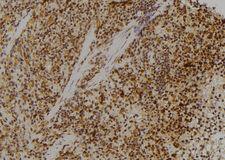 RPL23 / Ribosomal Protein L23 Antibody - 1:100 staining rat spleen tissue by IHC-P. The sample was formaldehyde fixed and a heat mediated antigen retrieval step in citrate buffer was performed. The sample was then blocked and incubated with the antibody for 1.5 hours at 22°C. An HRP conjugated goat anti-rabbit antibody was used as the secondary.