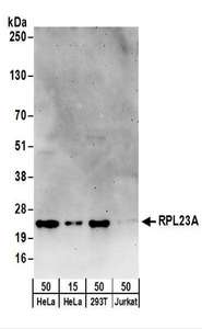 RPL23A Antibody - Detection of Human RPL23A by Western Blot. Samples: Whole cell lysate from HeLa (15 and 50 ug), 293T (50 ug), and Jurkat (50 ug) cells. Antibodies: Affinity purified rabbit anti-RPL23A antibody used for WB at 0.1 ug/ml. Detection: Chemiluminescence with an exposure time of 3 minutes.