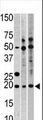 RPL23A Antibody - Western blot of anti-RPL23A antibody in, from left to right, CEM, HeLa, and HepG2 cell line lysates (35 ug/lane). RPL23A (arrow) was detected using the purified antibody.