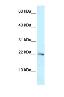 RPL23A Antibody - RPL23A antibody Western blot of ACHN Cell lysate. Antibody concentration 1 ug/ml.  This image was taken for the unconjugated form of this product. Other forms have not been tested.