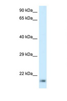 RPL23A Antibody - RPL23A antibody Western blot of Jurkat Cell lysate. Antibody concentration 1 ug/ml.  This image was taken for the unconjugated form of this product. Other forms have not been tested.