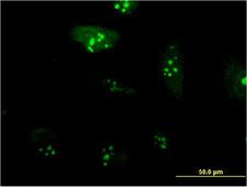 RPL23A Antibody - Immunofluorescence of monoclonal antibody to RPL23A on HeLa cell . [antibody concentration 10 ug/ml]