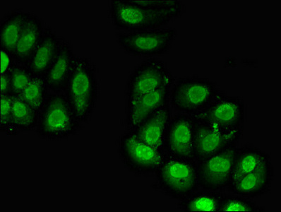 RPL23A Antibody - Immunofluorescent analysis of A549 cells diluted at 1:100 and Alexa Fluor 488-congugated AffiniPure Goat Anti-Rabbit IgG(H+L)