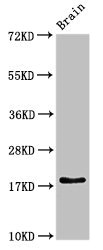 RPL23A Antibody - Western Blot Positive WB detected in:Rat brain tissue All Lanes:RPL23A antibody at 3µg/ml Secondary Goat polyclonal to rabbit IgG at 1/50000 dilution Predicted band size: 18 KDa Observed band size: 18 KDa