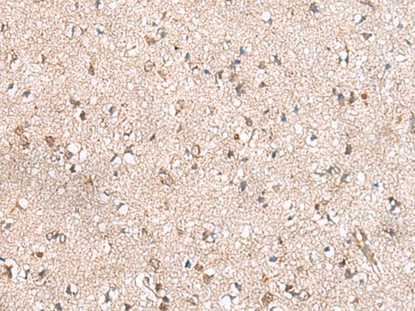 RPL23A Antibody - Immunohistochemistry of paraffin-embedded Human brain tissue  using RPL23A Polyclonal Antibody at dilution of 1:50(×200)