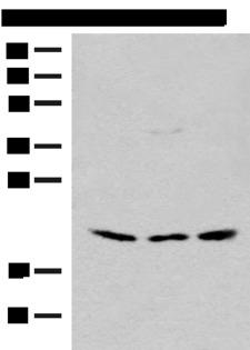 RPL23A Antibody - Western blot analysis of HEPG2 and Hela cell Mouse liver tissue lysates  using RPL23A Polyclonal Antibody at dilution of 1:300