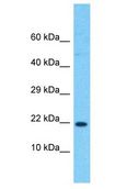 RPL24 / Ribosomal Protein L24 Antibody - RPL24 antibody Western Blot of Jurkat. Antibody dilution: 1 ug/ml.  This image was taken for the unconjugated form of this product. Other forms have not been tested.
