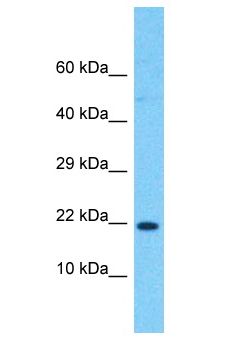 RPL24 / Ribosomal Protein L24 Antibody - RPL24 antibody Western Blot of Jurkat. Antibody dilution: 1 ug/ml.  This image was taken for the unconjugated form of this product. Other forms have not been tested.