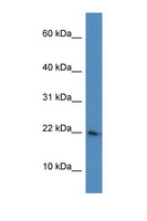 RPL26 / Ribosomal Protein L26 Antibody - RPL26 antibody Western blot of HeLa Cell lysate. Antibody concentration 1 ug/ml.  This image was taken for the unconjugated form of this product. Other forms have not been tested.