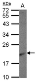 RPL26 / Ribosomal Protein L26 Antibody - Sample (30 ug of whole cell lysate) A: HCT116 12% SDS PAGE RPL26 antibody diluted at 1:1000