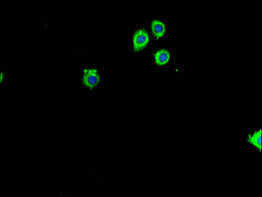 RPL26 / Ribosomal Protein L26 Antibody - Immunofluorescent analysis of HepG2 cells using RPL26 Antibody at a dilution of 1:100 and Alexa Fluor 488-congugated AffiniPure Goat Anti-Rabbit IgG(H+L)