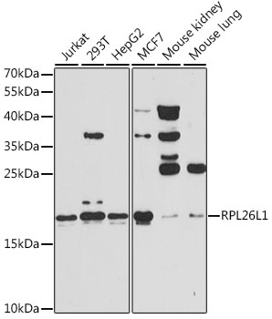 RPL26L1 Antibody - Western blot analysis of extracts of various cell lines, using RPL26L1 antibody at 1:3000 dilution. The secondary antibody used was an HRP Goat Anti-Rabbit IgG (H+L) at 1:10000 dilution. Lysates were loaded 25ug per lane and 3% nonfat dry milk in TBST was used for blocking. An ECL Kit was used for detection and the exposure time was 60s.