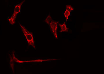 RPL26L1 Antibody - Staining HuvEc cells by IF/ICC. The samples were fixed with PFA and permeabilized in 0.1% Triton X-100, then blocked in 10% serum for 45 min at 25°C. The primary antibody was diluted at 1:200 and incubated with the sample for 1 hour at 37°C. An Alexa Fluor 594 conjugated goat anti-rabbit IgG (H+L) antibody, diluted at 1/600, was used as secondary antibody.