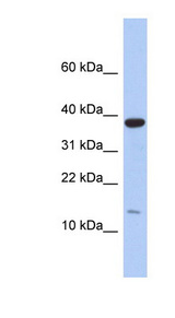 RPL27 / Ribosomal Protein L27 Antibody - RPL27 antibody Western blot of Fetal Small Intestine lysate. This image was taken for the unconjugated form of this product. Other forms have not been tested.