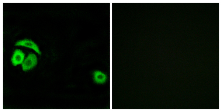 RPL27A Antibody - Immunofluorescence analysis of A549 cells, using RPL27A Antibody. The picture on the right is blocked with the synthesized peptide.