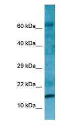 RPL27A Antibody - RPL27A antibody Western Blot of Fetal kidney.  This image was taken for the unconjugated form of this product. Other forms have not been tested.