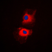 RPL27A Antibody - Immunofluorescent analysis of RPL27A staining in K562 cells. Formalin-fixed cells were permeabilized with 0.1% Triton X-100 in TBS for 5-10 minutes and blocked with 3% BSA-PBS for 30 minutes at room temperature. Cells were probed with the primary antibody in 3% BSA-PBS and incubated overnight at 4 C in a humidified chamber. Cells were washed with PBST and incubated with a DyLight 594-conjugated secondary antibody (red) in PBS at room temperature in the dark. DAPI was used to stain the cell nuclei (blue).