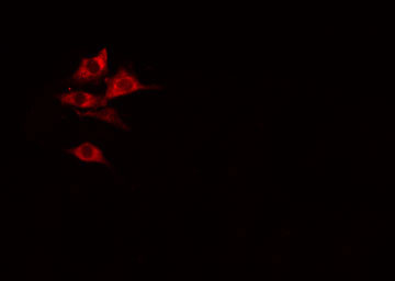 RPL27A Antibody - Staining COLO205 cells by IF/ICC. The samples were fixed with PFA and permeabilized in 0.1% Triton X-100, then blocked in 10% serum for 45 min at 25°C. The primary antibody was diluted at 1:200 and incubated with the sample for 1 hour at 37°C. An Alexa Fluor 594 conjugated goat anti-rabbit IgG (H+L) antibody, diluted at 1/600, was used as secondary antibody.