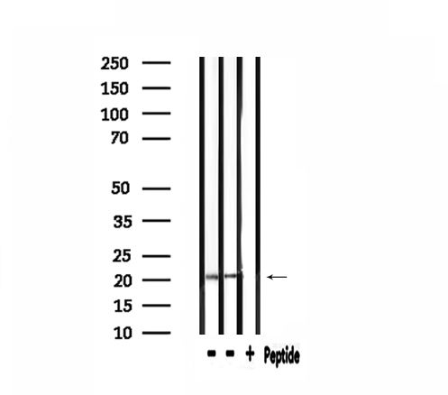 RPL27A Antibody - Western blot analysis of extracts of HepG2 and rat liver tissue using RPL27A antibody.