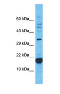 RPL27A Antibody - Western blot of RPL27A Antibody with human PANC1 Whole Cell lysate.  This image was taken for the unconjugated form of this product. Other forms have not been tested.