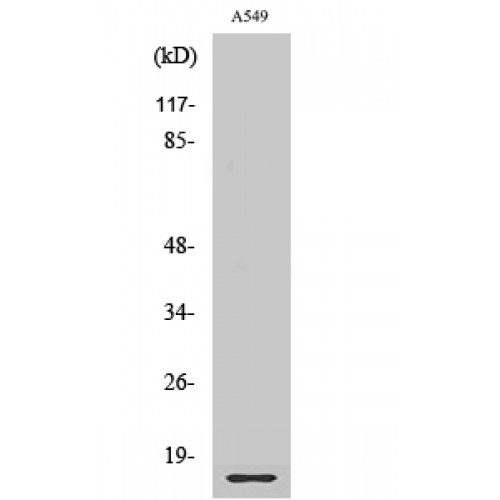 RPL28 / Ribosomal Protein L28 Antibody - Western blot of Ribosomal Protein L28 antibody