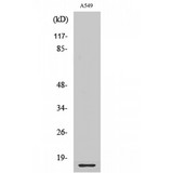 RPL28 / Ribosomal Protein L28 Antibody - Western blot of Ribosomal Protein L28 antibody