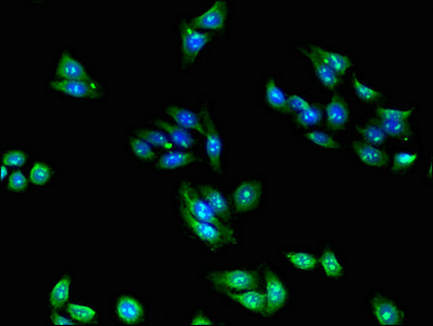 RPL28 / Ribosomal Protein L28 Antibody - Immunofluorescent analysis of HepG2 cells using RPL28 Antibody at dilution of 1:100