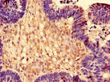 RPL28 / Ribosomal Protein L28 Antibody - Immunohistochemistry of paraffin-embedded human ovarian cancer using RPL28 Antibody at dilution of 1:100