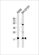 RPL28 / Ribosomal Protein L28 Antibody - All lanes : Anti-RPL28 Antibody at 1:1000 dilution Lane 1: A549 whole cell lysates Lane 2: SH-SY5Y whole cell lysates Lysates/proteins at 20 ug per lane. Secondary Goat Anti-Rabbit IgG, (H+L),Peroxidase conjugated at 1/10000 dilution Predicted band size : 15 kDa Blocking/Dilution buffer: 5% NFDM/TBST.