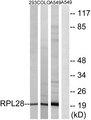 RPL28 / Ribosomal Protein L28 Antibody - Western blot analysis of extracts from 293 cells, COLO cells and A549 cells, using RPL28 antibody.