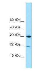 RPL28 / Ribosomal Protein L28 Antibody - RPL28 antibody Western Blot of 293T.  This image was taken for the unconjugated form of this product. Other forms have not been tested.