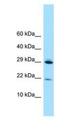 RPL28 / Ribosomal Protein L28 Antibody - RPL28 antibody Western Blot of 293T.  This image was taken for the unconjugated form of this product. Other forms have not been tested.