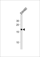 RPL29 / Ribosomal Protein L29 Antibody - RPL29 Antibody western blot of SW480 cell line lysates (35 ug/lane). The RPL29 antibody detected the RPL29 protein (arrow).