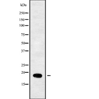 RPL29 / Ribosomal Protein L29 Antibody - Western blot analysis of RPL29 using COLO205 whole cells lysates
