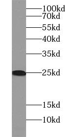 RPL29 / Ribosomal Protein L29 Antibody - HepG2 cells were subjected to SDS PAGE followed by western blot with RPL29 antibody at dilution of 1:600