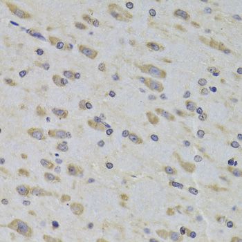 RPL3 / Ribosomal Protein L3 Antibody - Immunohistochemistry of paraffin-embedded rat brain using RPL3 Antibody at dilution of 1:100 (40x lens).