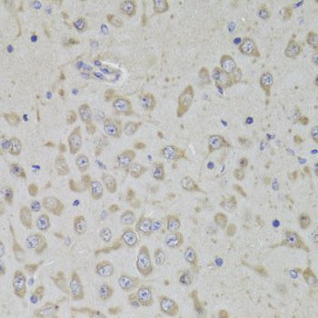RPL3 / Ribosomal Protein L3 Antibody - Immunohistochemistry of paraffin-embedded mouse brain using RPL3 Antibody at dilution of 1:100 (40x lens).