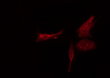RPL3 / Ribosomal Protein L3 Antibody - Staining HT29 cells by IF/ICC. The samples were fixed with PFA and permeabilized in 0.1% Triton X-100, then blocked in 10% serum for 45 min at 25°C. The primary antibody was diluted at 1:200 and incubated with the sample for 1 hour at 37°C. An Alexa Fluor 594 conjugated goat anti-rabbit IgG (H+L) antibody, diluted at 1/600, was used as secondary antibody.