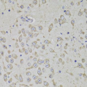 RPL3 / Ribosomal Protein L3 Antibody - Immunohistochemistry of paraffin-embedded Mouse brain using RPL3 Polyclonal Antibody at dilution of 1:100 (40x lens).