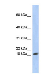 RPL30 / Ribosomal Protein L30 Antibody - RPL30 antibody Western blot of Placenta lysate. This image was taken for the unconjugated form of this product. Other forms have not been tested.