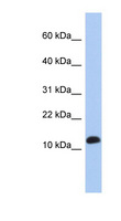 RPL30 / Ribosomal Protein L30 Antibody - RPL30 antibody Western blot of Jurkat lysate. This image was taken for the unconjugated form of this product. Other forms have not been tested.