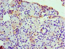 RPL30 / Ribosomal Protein L30 Antibody - Immunohistochemistry of paraffin-embedded human pancreatic tissue using RPL30 Antibody at dilution of 1:100