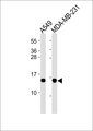 RPL30 / Ribosomal Protein L30 Antibody - All lanes : Anti-RPL30 Antibody at 1:4000 dilution Lane 1: A549 whole cell lysates Lane 2: MDA-MB-231 whole cell lysates Lysates/proteins at 20 ug per lane. Secondary Goat Anti-Rabbit IgG, (H+L),Peroxidase conjugated at 1/10000 dilution Predicted band size : 12 kDa Blocking/Dilution buffer: 5% NFDM/TBST.